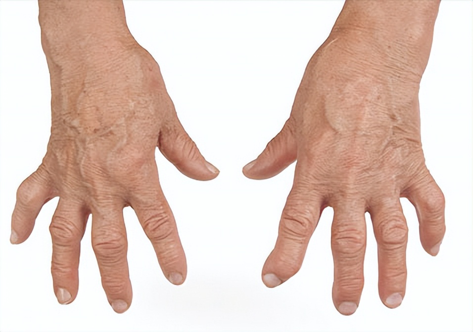 长期关节炎疼痛解决最好办法,小关节疼痛是怎么治愈