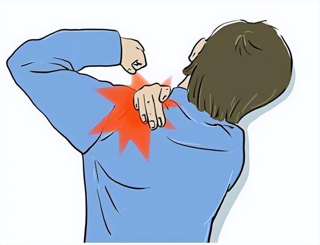 肩疼持续一年多了会不会是癌症,癌症引起的肩痛症状