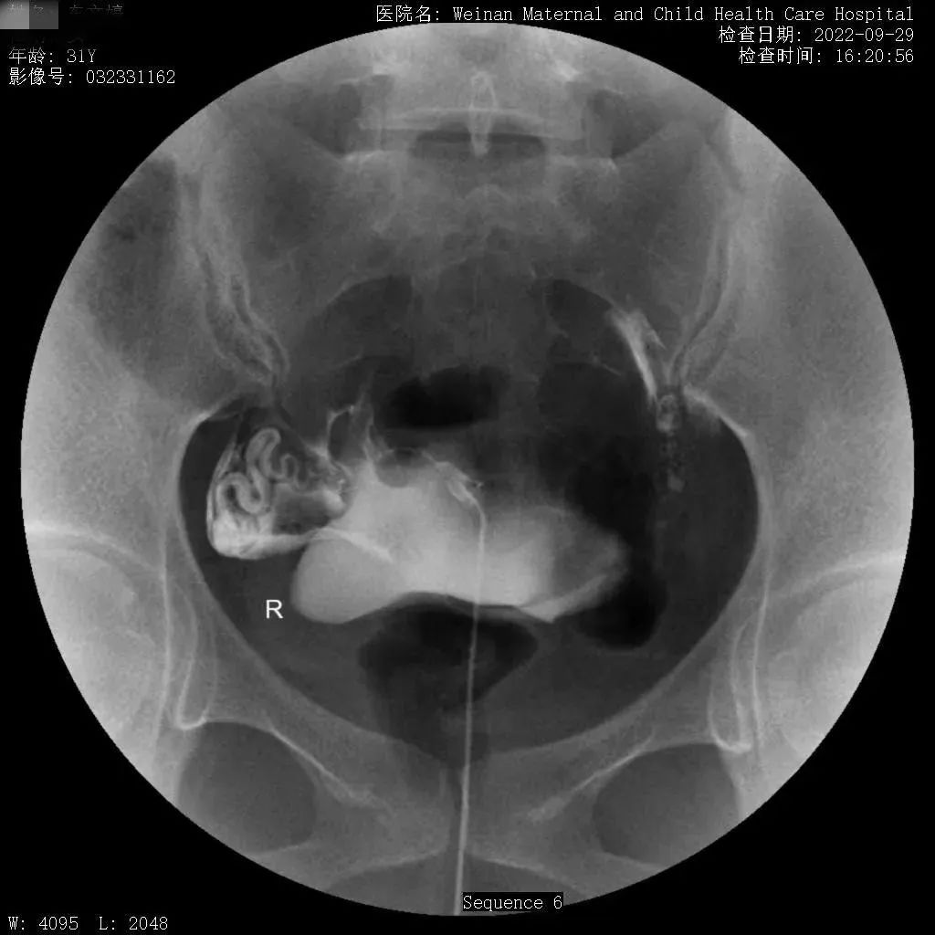 致敬公司的摄影师,美女致敬摄影师视频