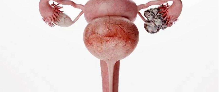 我安享晚年的年纪，却闻到自己身上有腥臭味，还伴有排液、瘙痒