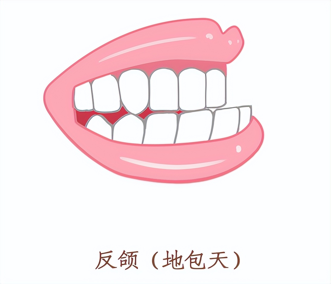 7岁小孩睡觉张嘴打鼾,5岁小朋友打鼾