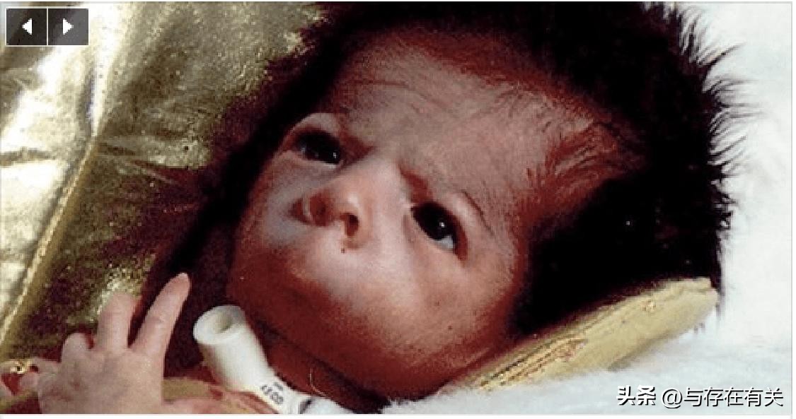 没有下巴的男人怎么改善,没有下巴的男人命运怎么样