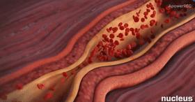 足球名将王涛，演员陆树铭因心梗去世，心梗越来越年轻化？