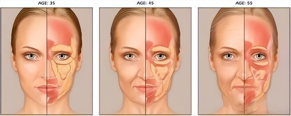 暨中研|专利无创电子互斥通道技术:一个从医学到骨膜抗衰的传奇