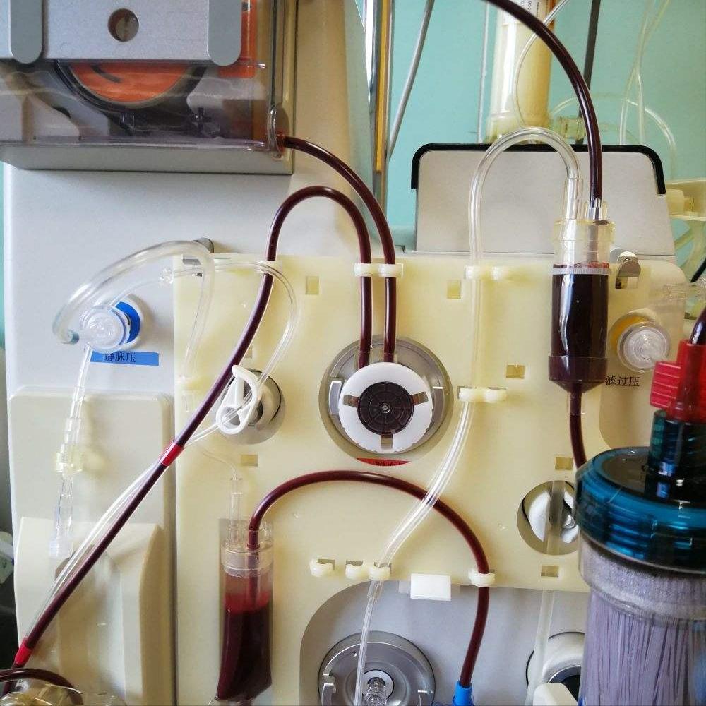 婴儿先天性心脏病怎么护理,婴儿先天性心脏病做什么手术好