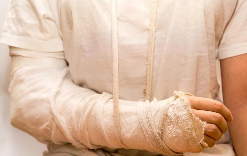 儿童肘关节骨折后屈曲受限,肘关节骨折后僵硬如何防反弹