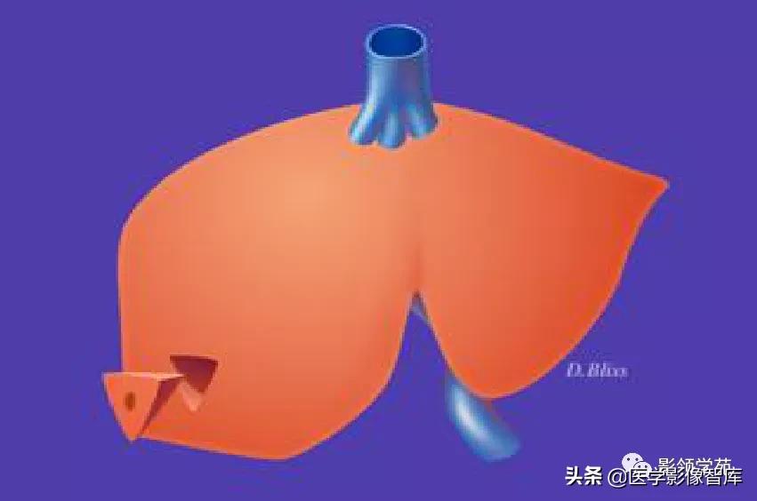 肝脏影像分叶分段解剖图,肝脏分段解剖图谱