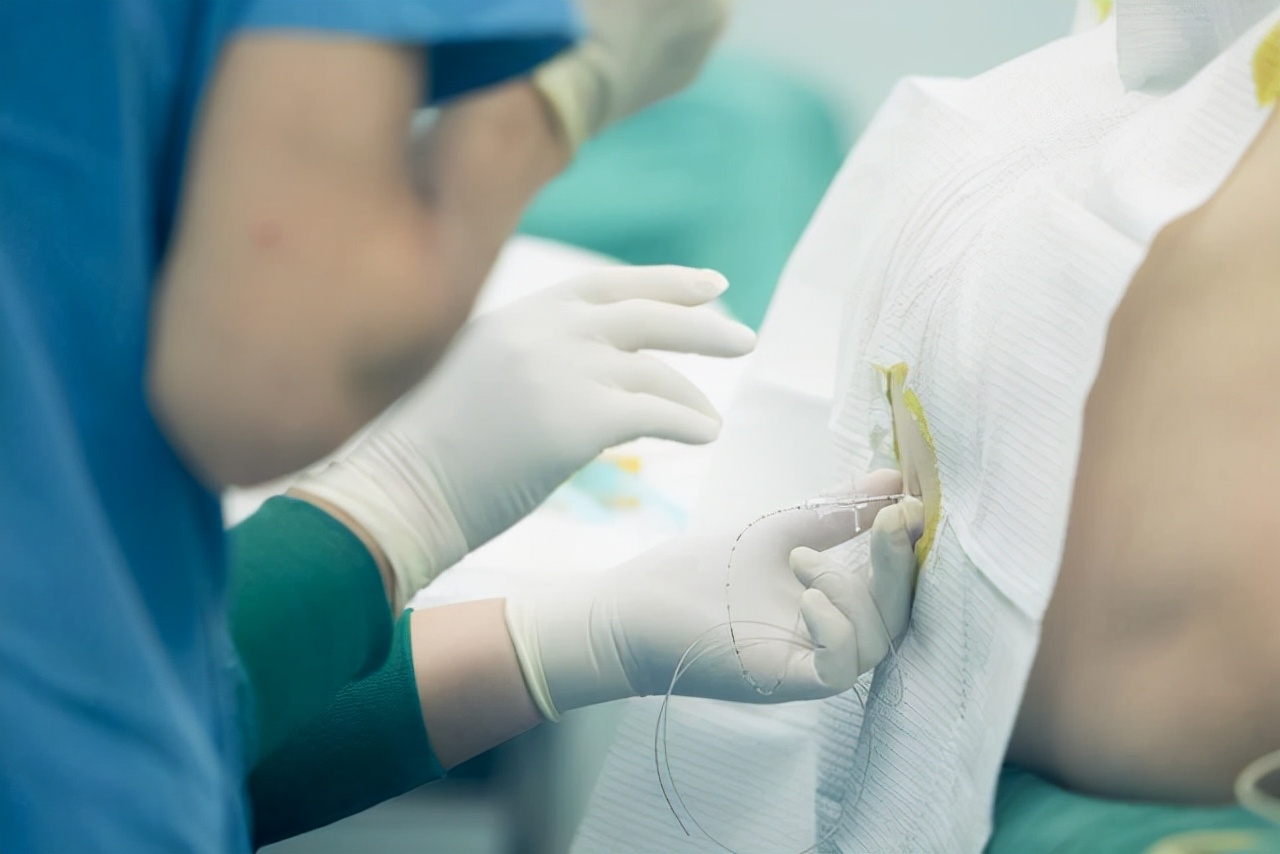 正经提醒：进行这5项手术时，或需要“全裸出镜”，不要太害羞