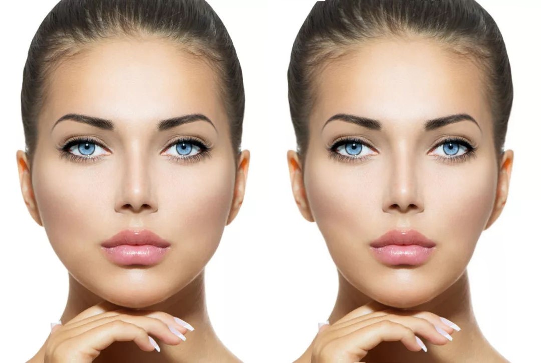 正畸真的有用吗,拔正畸牙会有后遗症吗