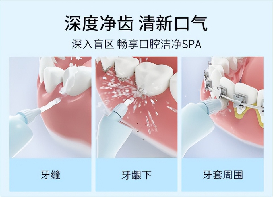 冲牙器会引起牙龈肿痛吗,冲牙器会让牙龈发紫吗