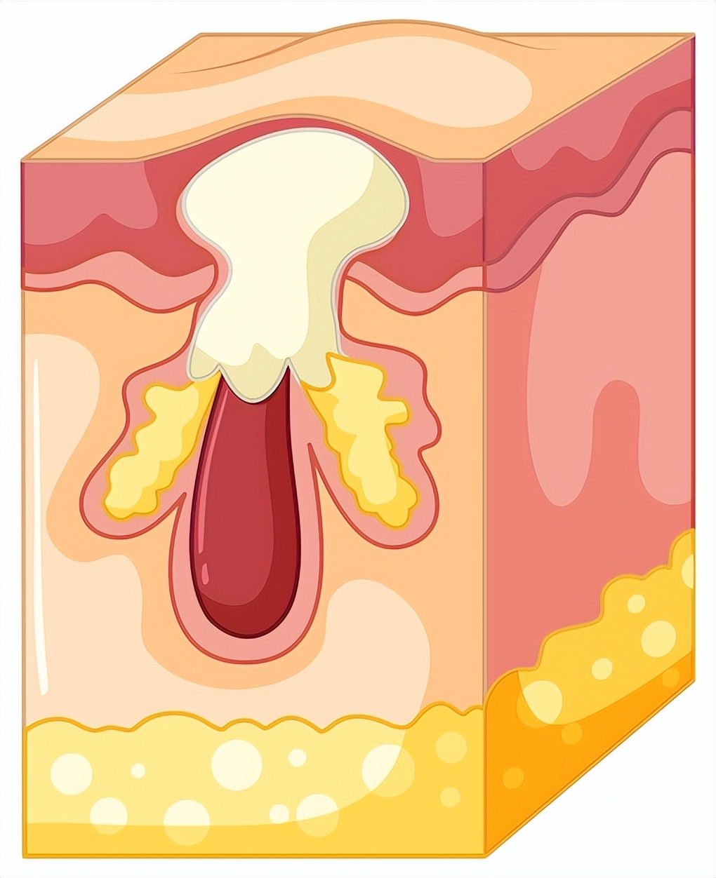 头皮反反复复长痘是什么原因,毛囊炎脖子头皮后背长痘