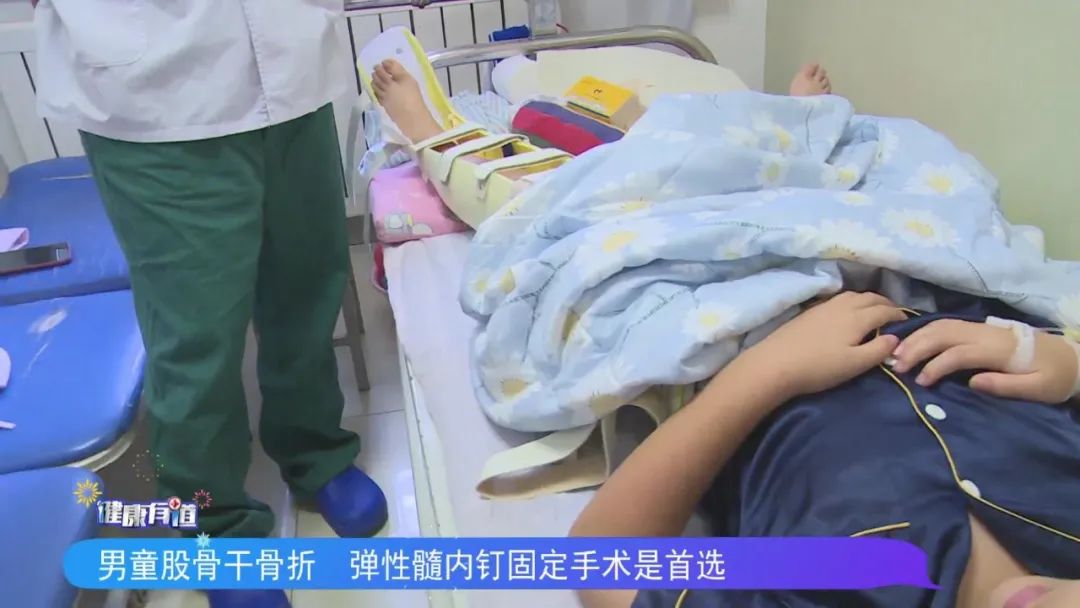 儿童股骨干骨折弹性髓内钉内固定,儿童股骨骨折打髓内钉
