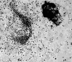 菊花周围真菌感染了怎么办,菊花周边真菌感染