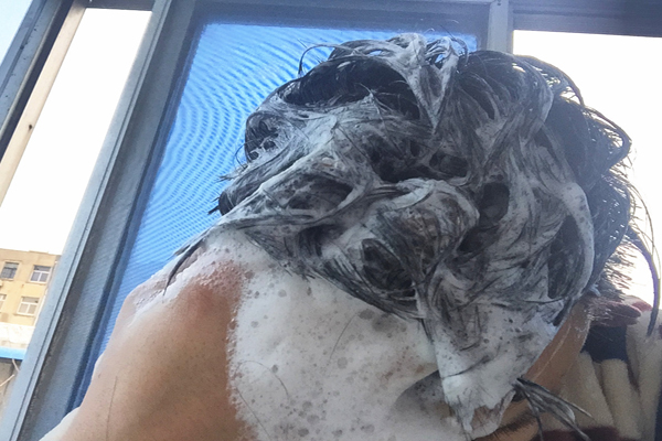 头皮总是出油有味道,头皮老是出油还有痘痘是什么原因