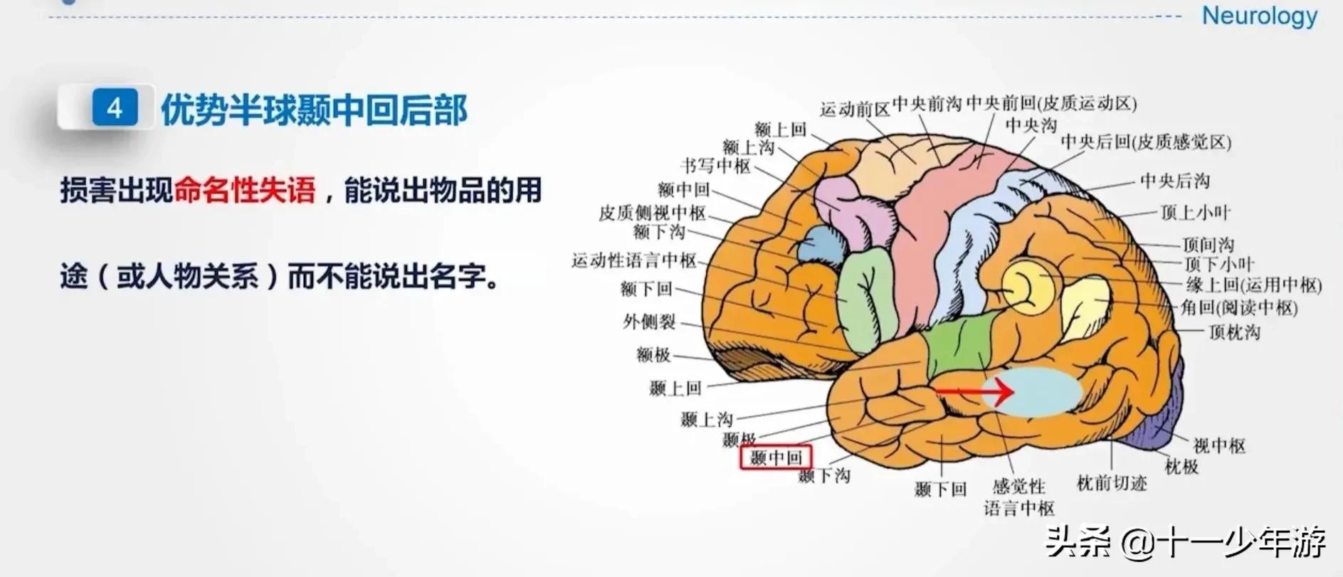 大脑的结构解剖示意图,大脑镰下疝解剖结构