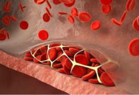 进口他汀怎么选,进口他汀比国产副作用少吗