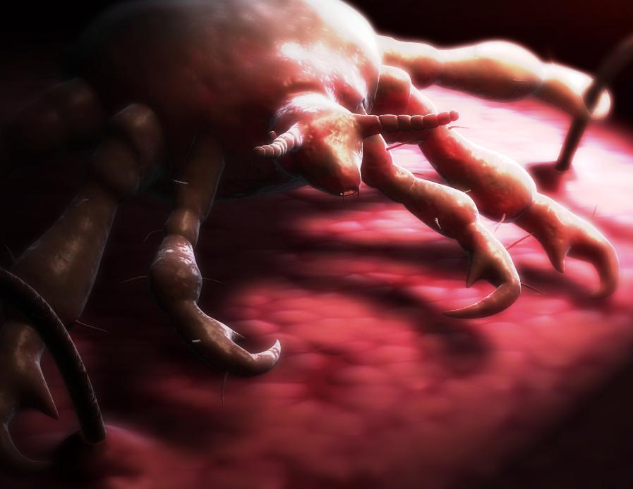 把阴虱用镊子找出来可以吗,阴虱是怎么通过性传播的