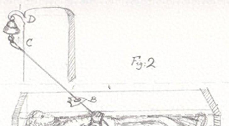 13个活久见事实：全世界嘴巴最大的女人，阴道长“牙齿”