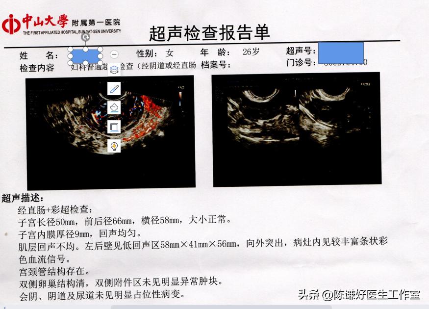 未婚未育子宫肌瘤该如何处理？