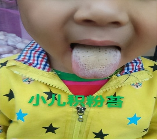 小儿豉翘清热颗粒影响新冠疫苗吗,小儿豉翘清热颗粒新冠肺炎