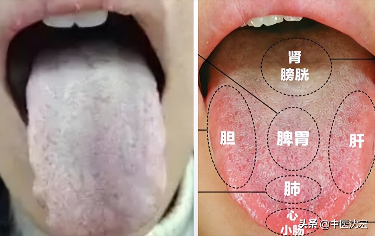 喉咙老有痰健脾祛湿化痰的中成药,喉咙痰多中医怎么祛痰