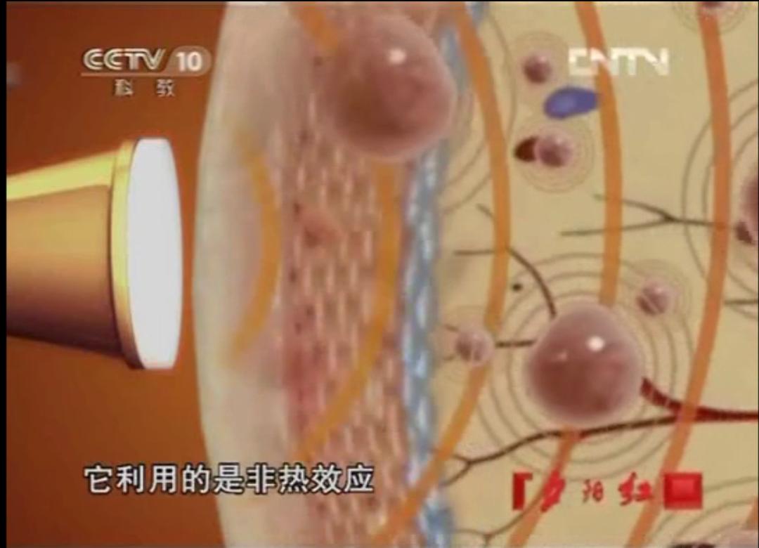 百全毫米波治疗仪的发明者,毫米波治疗仪适合老年人用吗