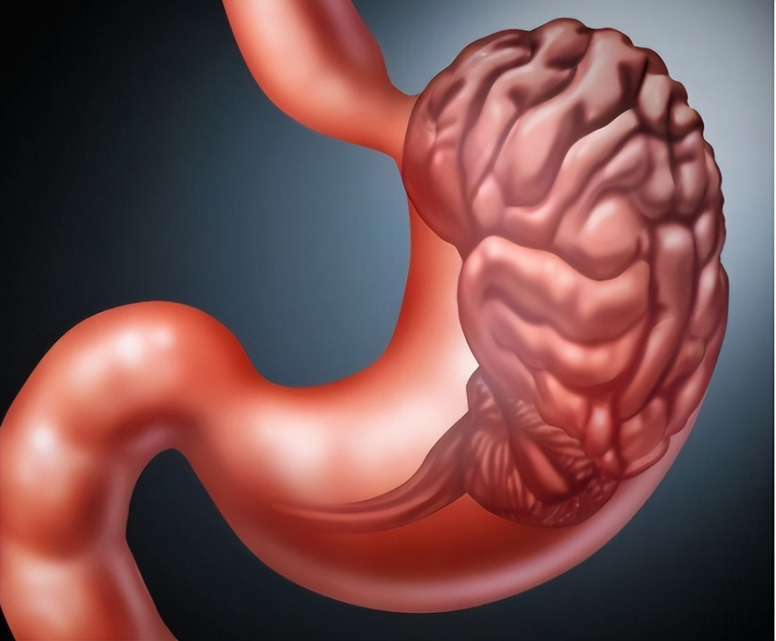 长期服用通心络麝香保心丸的好处,常吃麝香保心丸会便秘吗