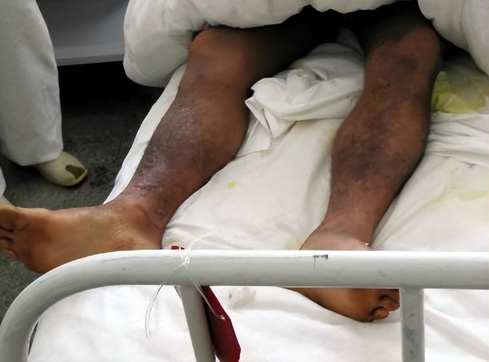 侵华日军销毁毒气弹,销毁侵华日军遗弃弹药