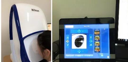 本想做近视手术，却发现眼底上破了个“洞”！需不需要治疗？