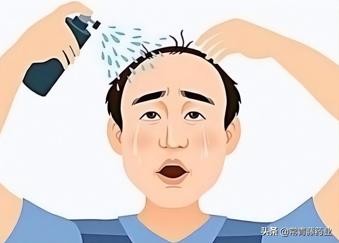 2%米诺地尔溶液怎么用,米诺地尔浓度2%和5%区别