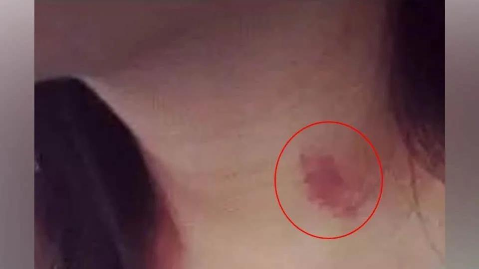 关于两性发文12:你有没有种草莓或被种草莓的经历？