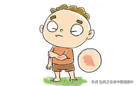 耳后皮肤痒脱皮怎么回事,皮肤痒抓了脱皮怎么回事