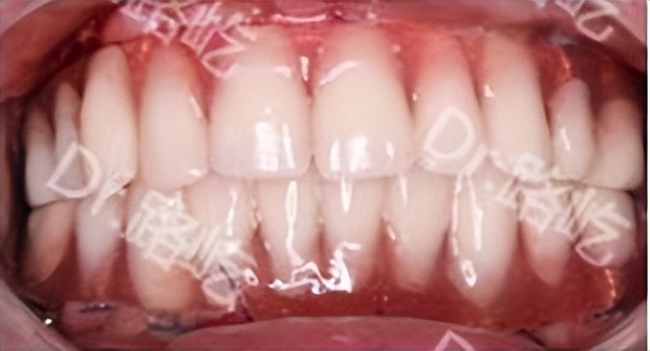 可恩口腔怎么样啊,可恩口腔好吗