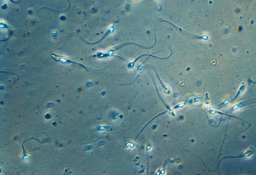 精子很稀得了无精症,精子稀如水是无精症吗