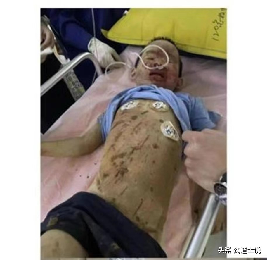 遗传的基因有多可怕,可怕的遗传基因有哪些