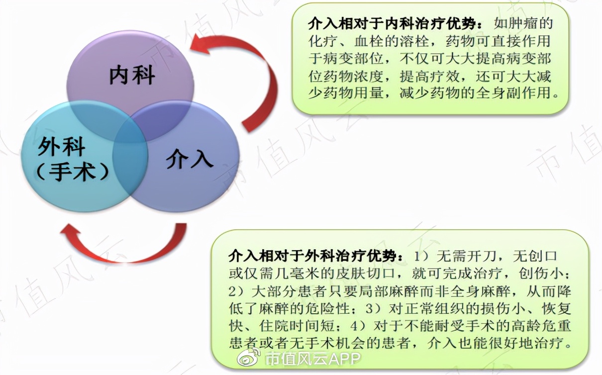 介入治疗室布局,一文看懂行业研究的精髓