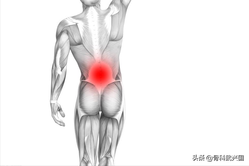 肌肉拉伤怎样快速恢复背部,背部肌肉拉伤贴膏药有用吗