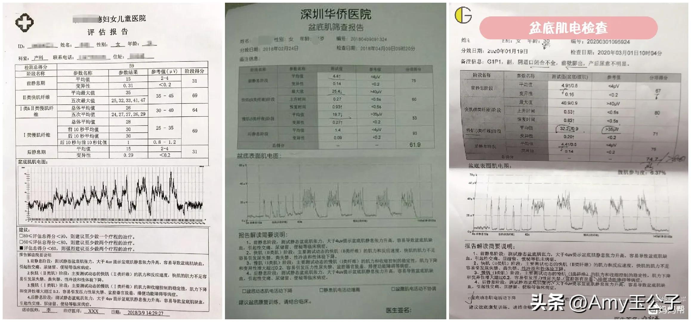 准妈妈必看产后修复小知识,哺乳期产后修复必做的项目