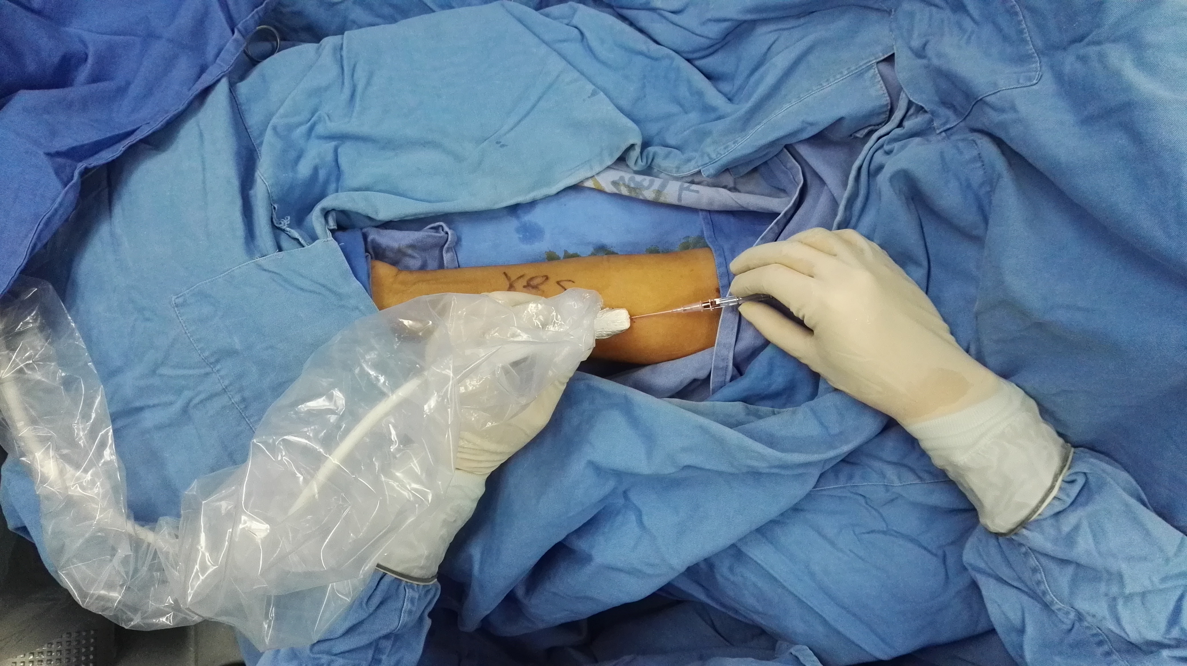 肝癌谷丙转氨酶和谷草转氨酶800多,谷丙转氨酶高多少可以断定为肝癌