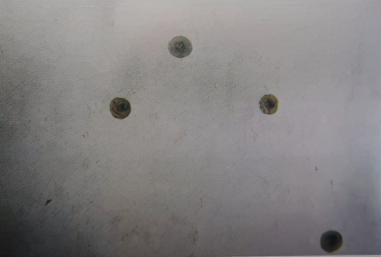 uu感染是什么意思,uu感染严重吗