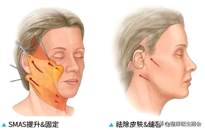 面部暗沉无光泽显老怎么改善,皮肤暗沉皱纹显老