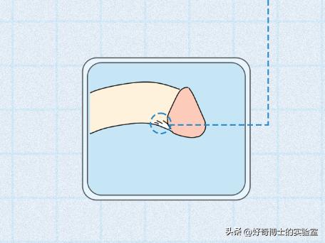 男生丁丁变歪是身体出了什么问题吗？影不影响*生活性**？