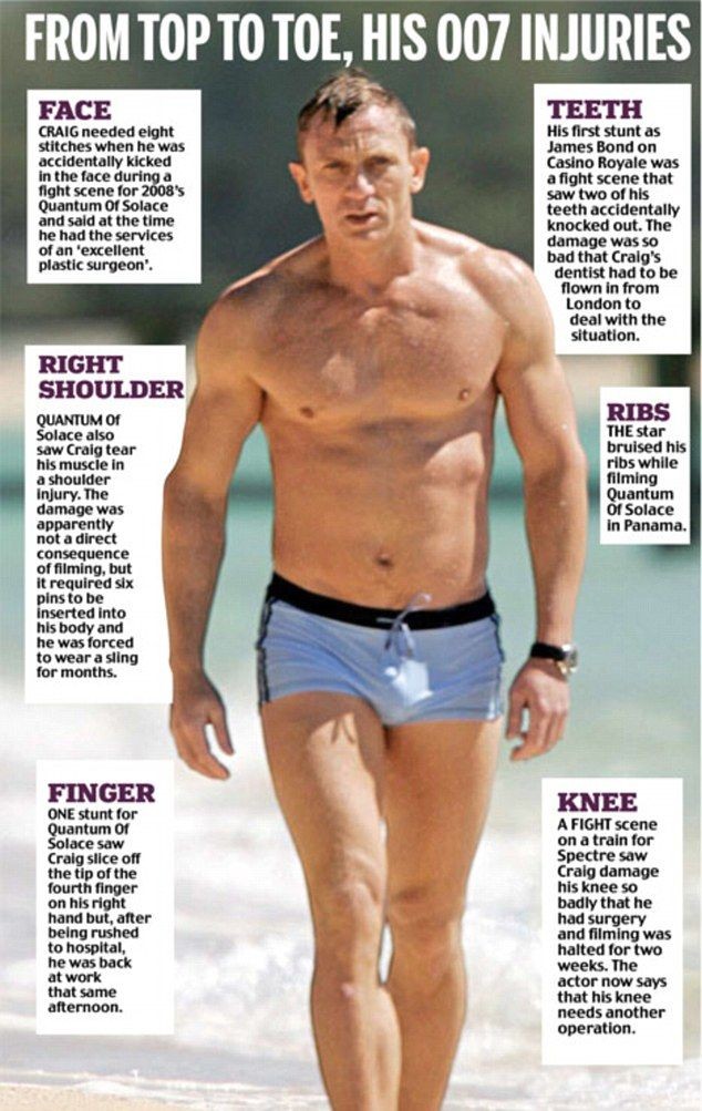 猎魔人卡维尔阿尔萨斯,亨利卡维尔超人入魔