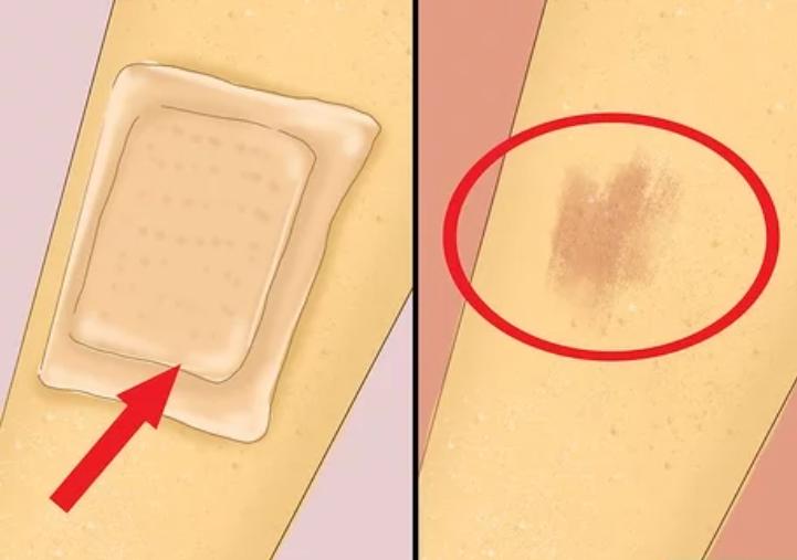 被擦伤了如何快速恢复,怎样护理伤疤