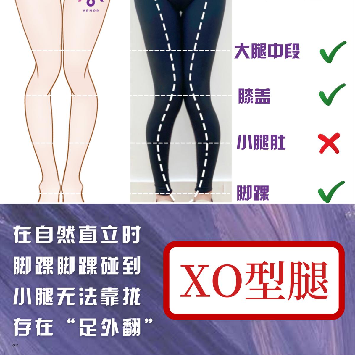 VEMOR变美干货|你了解你的腿形吗?