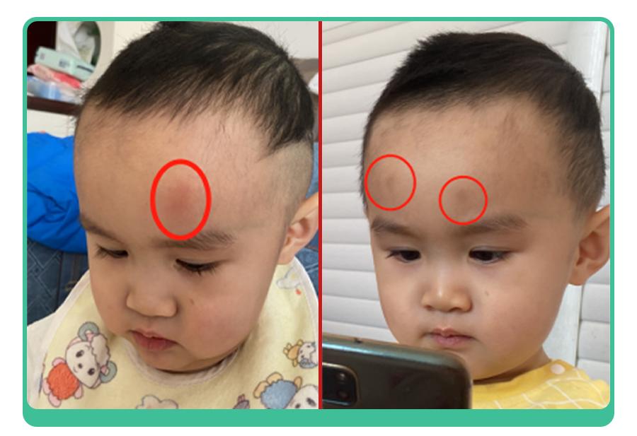 一生气就撞墙、打脸,娃这些“自虐”行为,暗藏2种情绪,你要懂