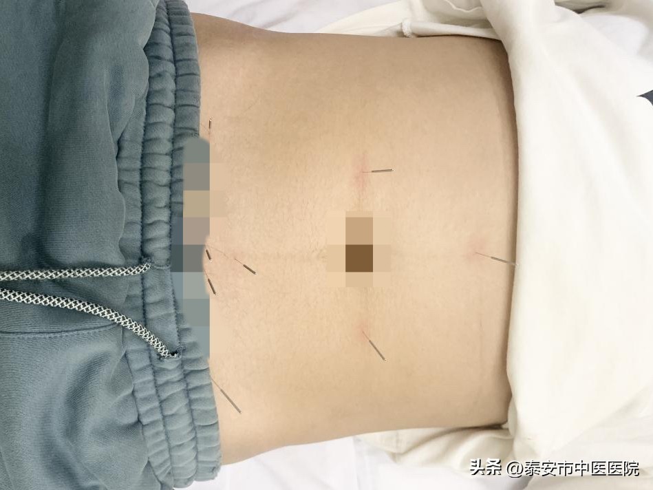 解决生育难题助圆“母亲梦”——*安泰**市中医医院针灸二科成立房繄恭专家工作室