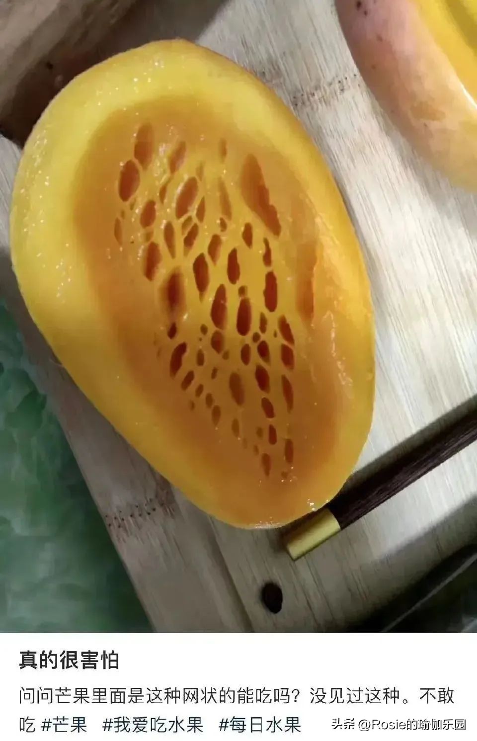 生育损伤合集,生育损伤有哪些