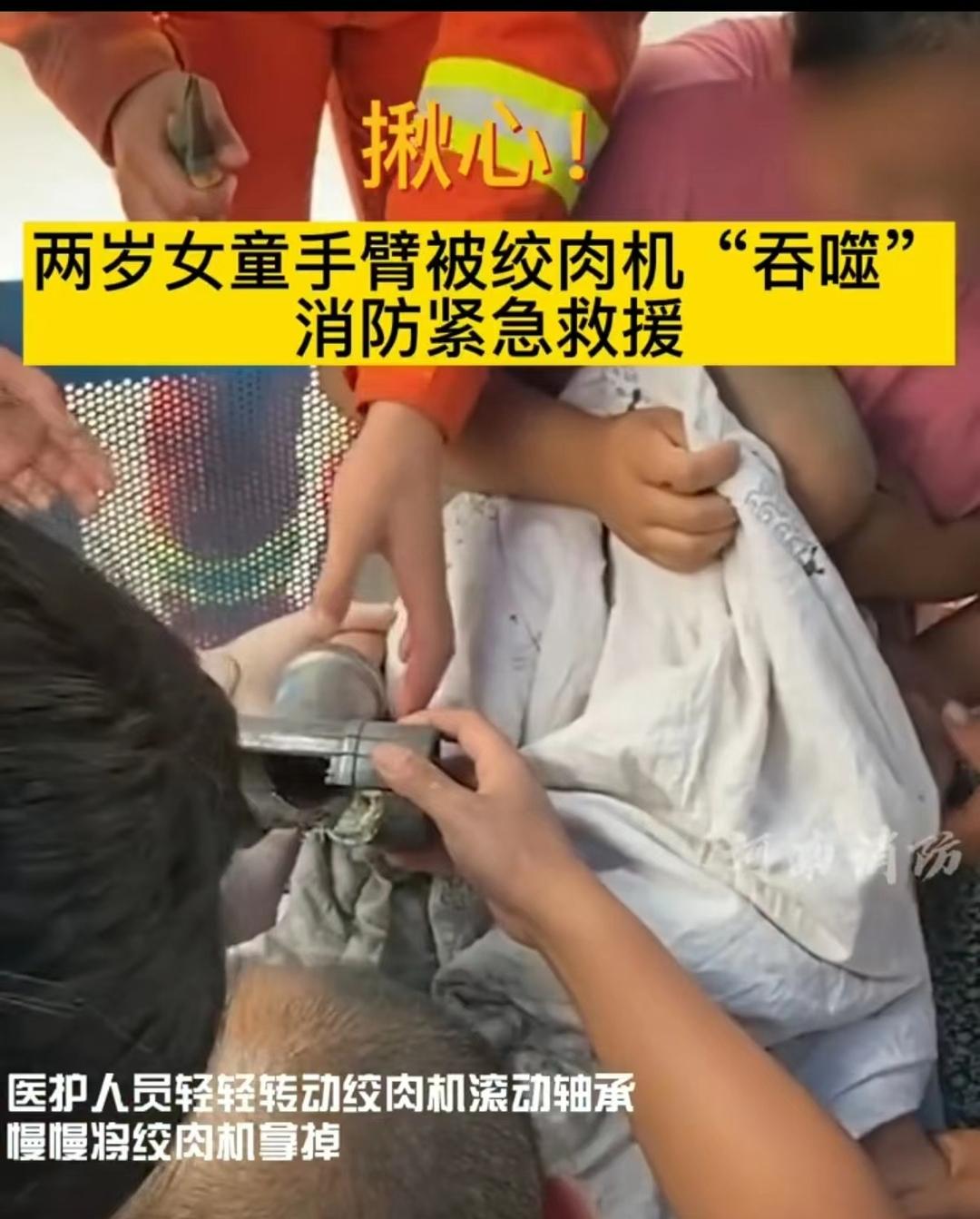 女子绞肉时手指被卡,工人手卡绞肉机血流不止