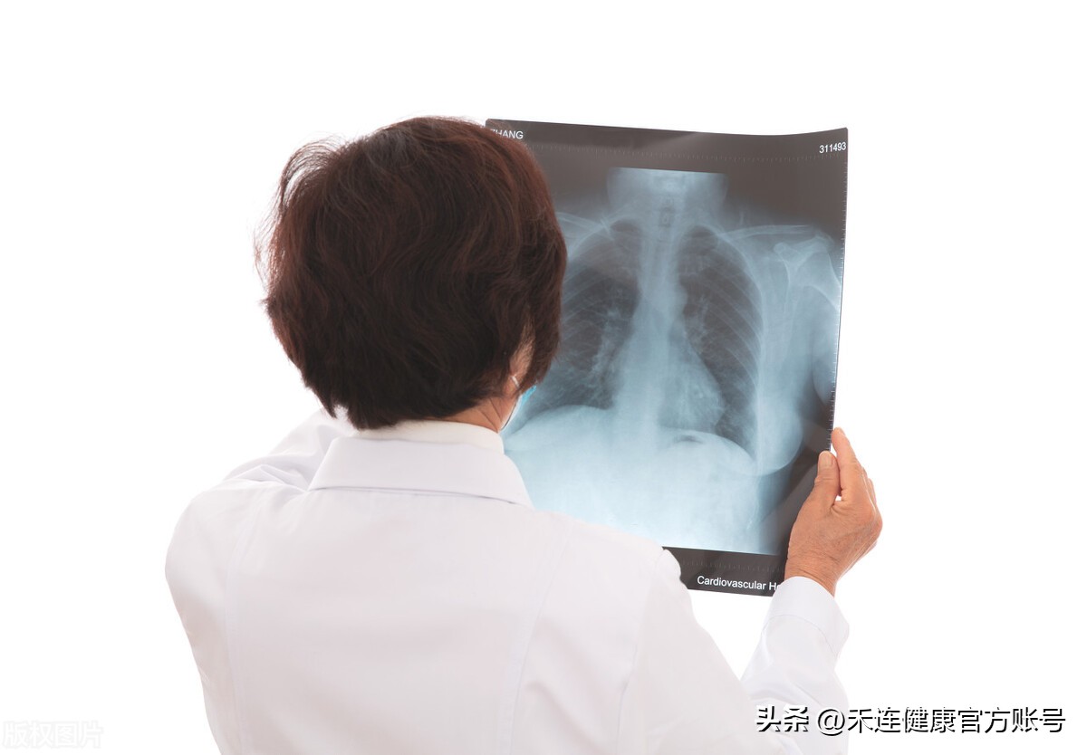 专家解读：白肺能被治愈吗？什么情况要拍CT？